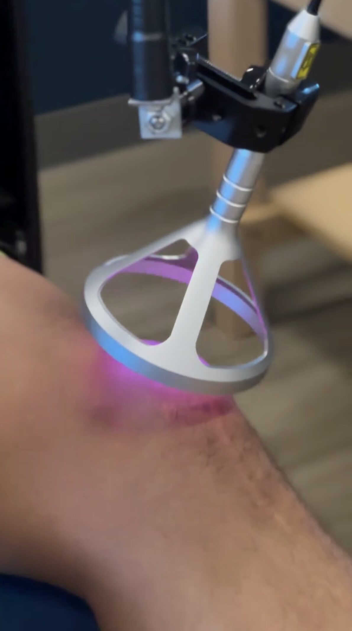 How Quickly Can You Experience Results with Class IV Laser Therapy