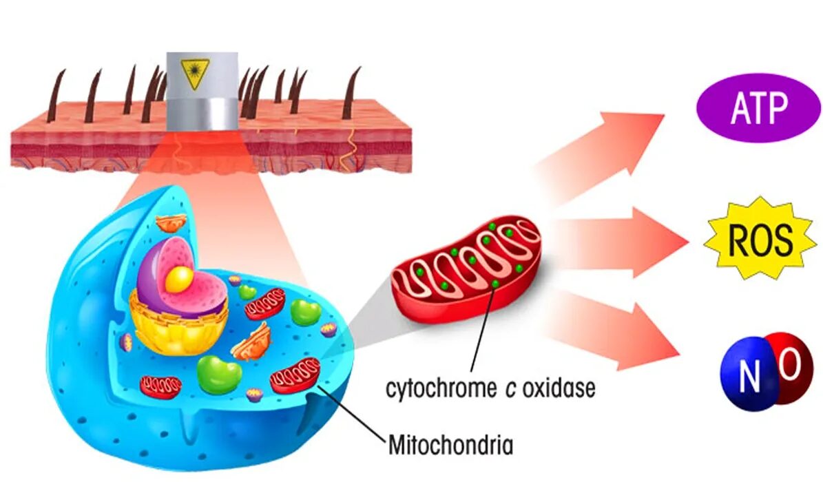 Understanding The Dynamics of Class IV Laser Therapy
